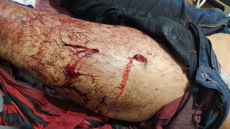 Homem é Esfaqueado Durante Encontro que Terminou em Violência