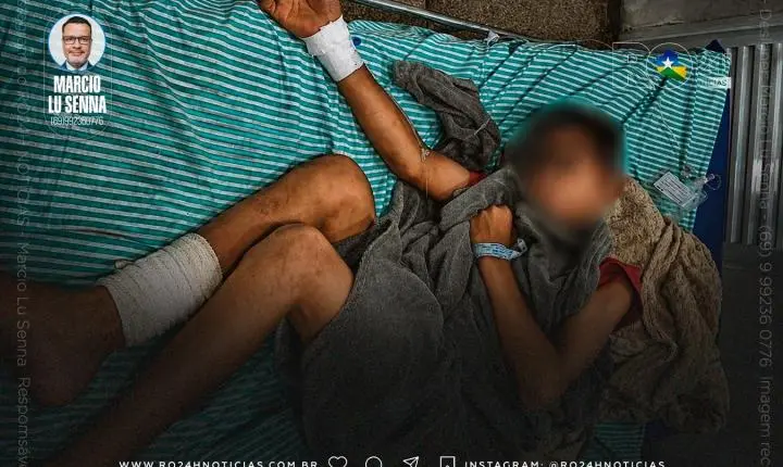 ADOLESCENTE TEM TENDÃO CORTADO POR LINHA COM CEROL